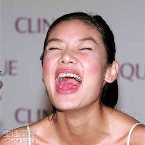 蛀牙的明星,揭秘明星们的口腔健康危机